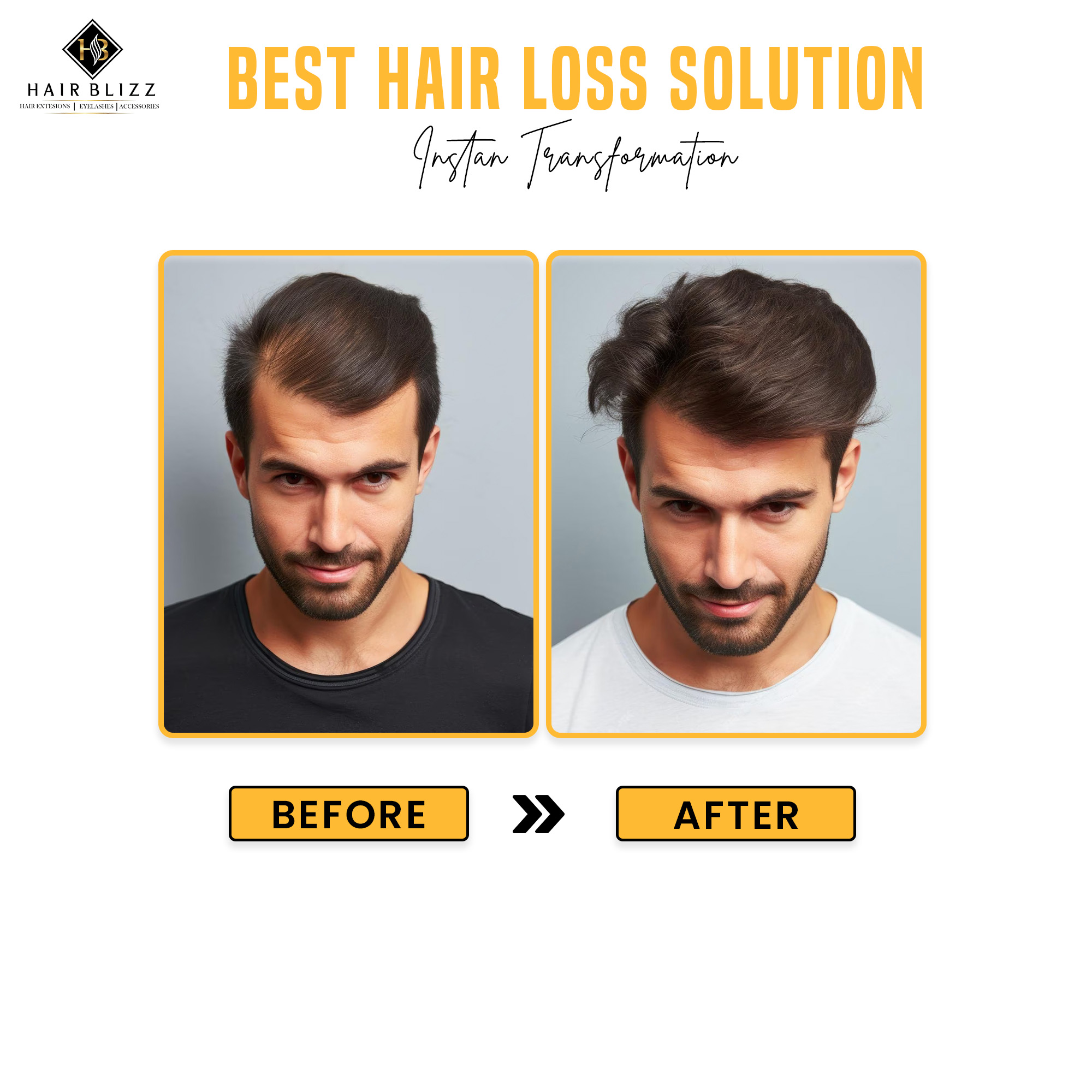 Australia Hair Patch